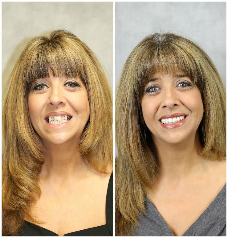 Dental Dentures Rockville MD 20847